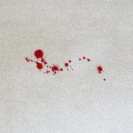 how to get rid of blood stains out of carpet